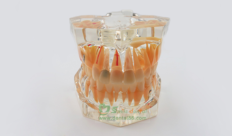 TM-C16-01 Pathology Model